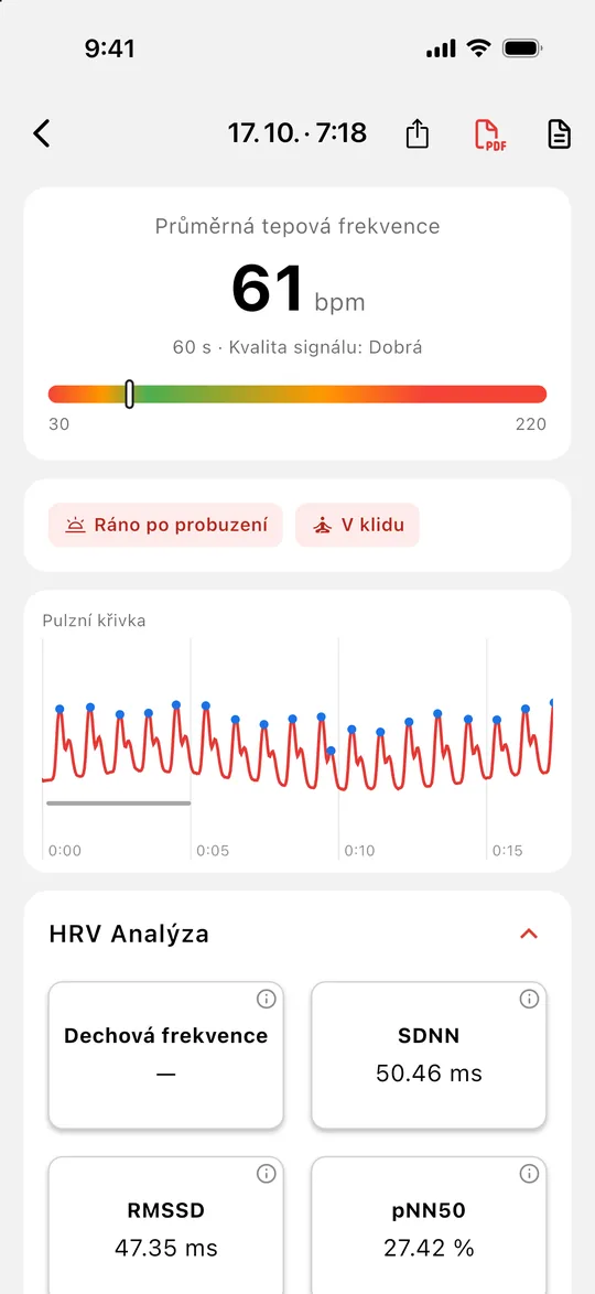 Detail měření s pulzní křivkou a parametry HRV