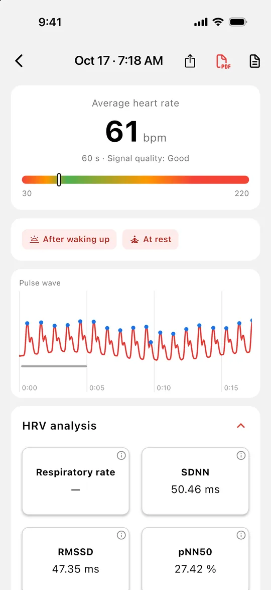 Reading detail with the pulse wave and HRV values